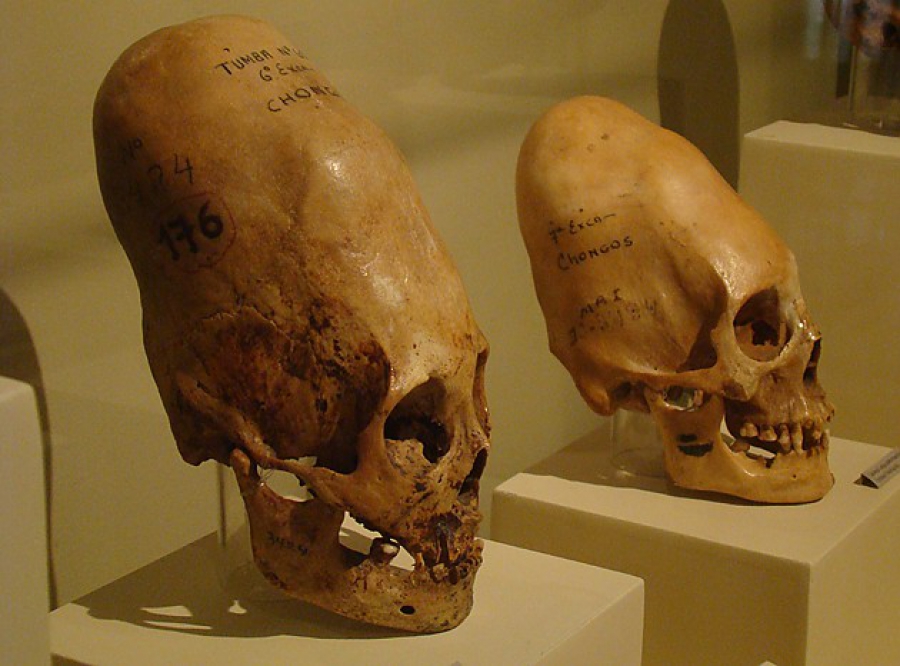 Вытянутые черепа из Паракаса принадлежат неизвестному подвиду человека жившему в Закавказье